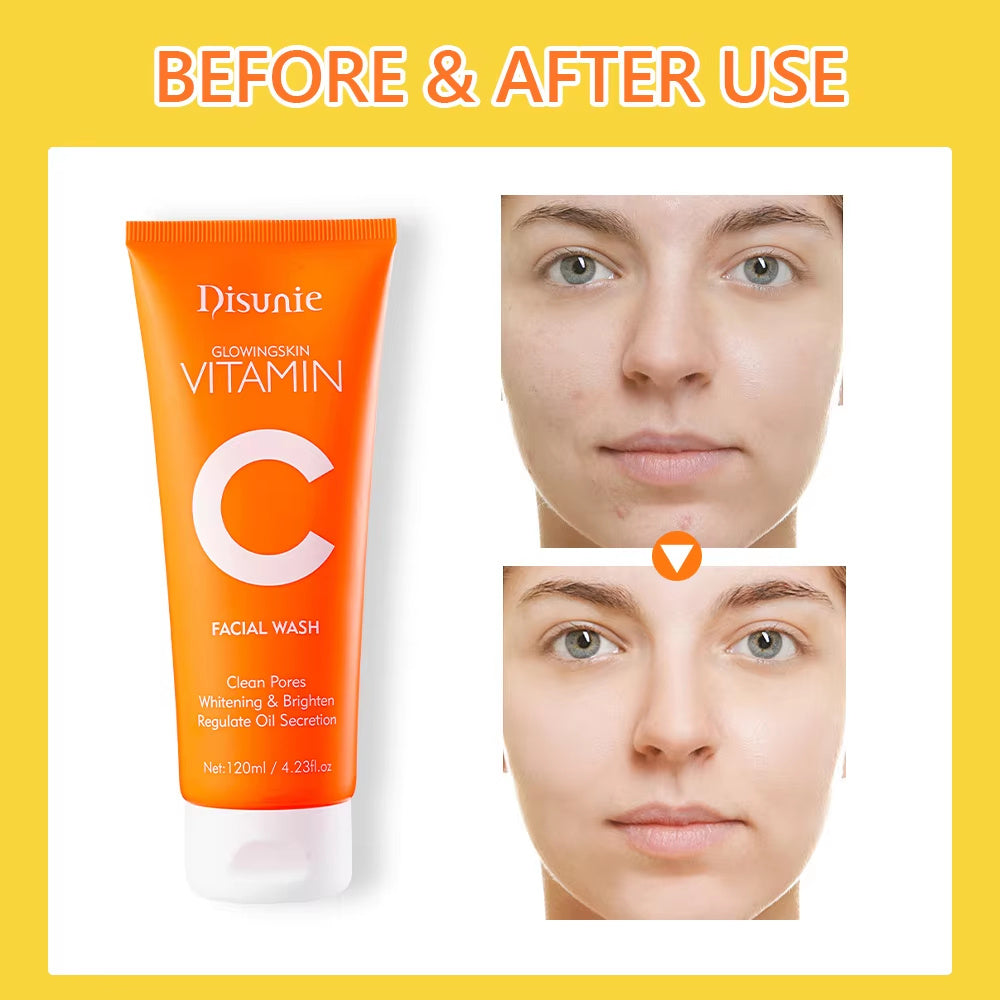 Vitamin C Amino Acid Facial Cleanser Face Glow And Cleans Whitening Brightening Oil Control Face Wash For Men Women - Loxvira