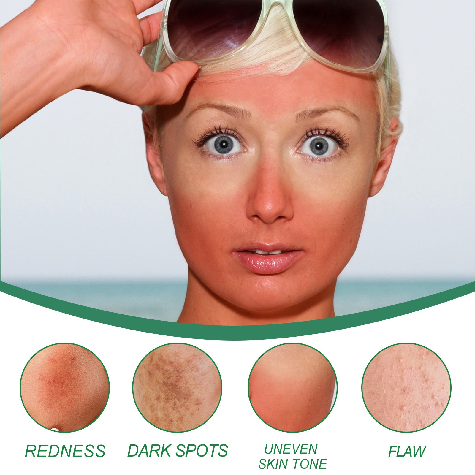 West&Month Color Correcting Care Cream – Spot Diminishing & Post-Sun Skin Recovery - Loxvira