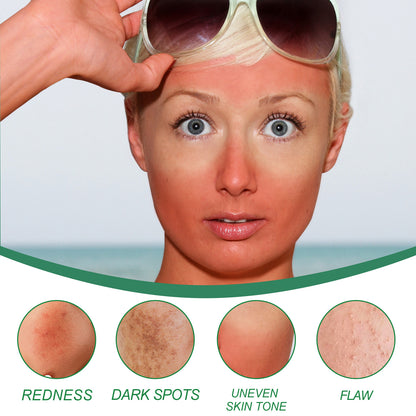 West&Month Color Correcting Care Cream – Spot Diminishing & Post-Sun Skin Recovery - Loxvira