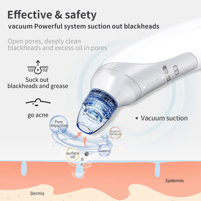 Electric Blackhead Suction Instrument – Home Use Blackhead & Acne Removal Device - Loxvira