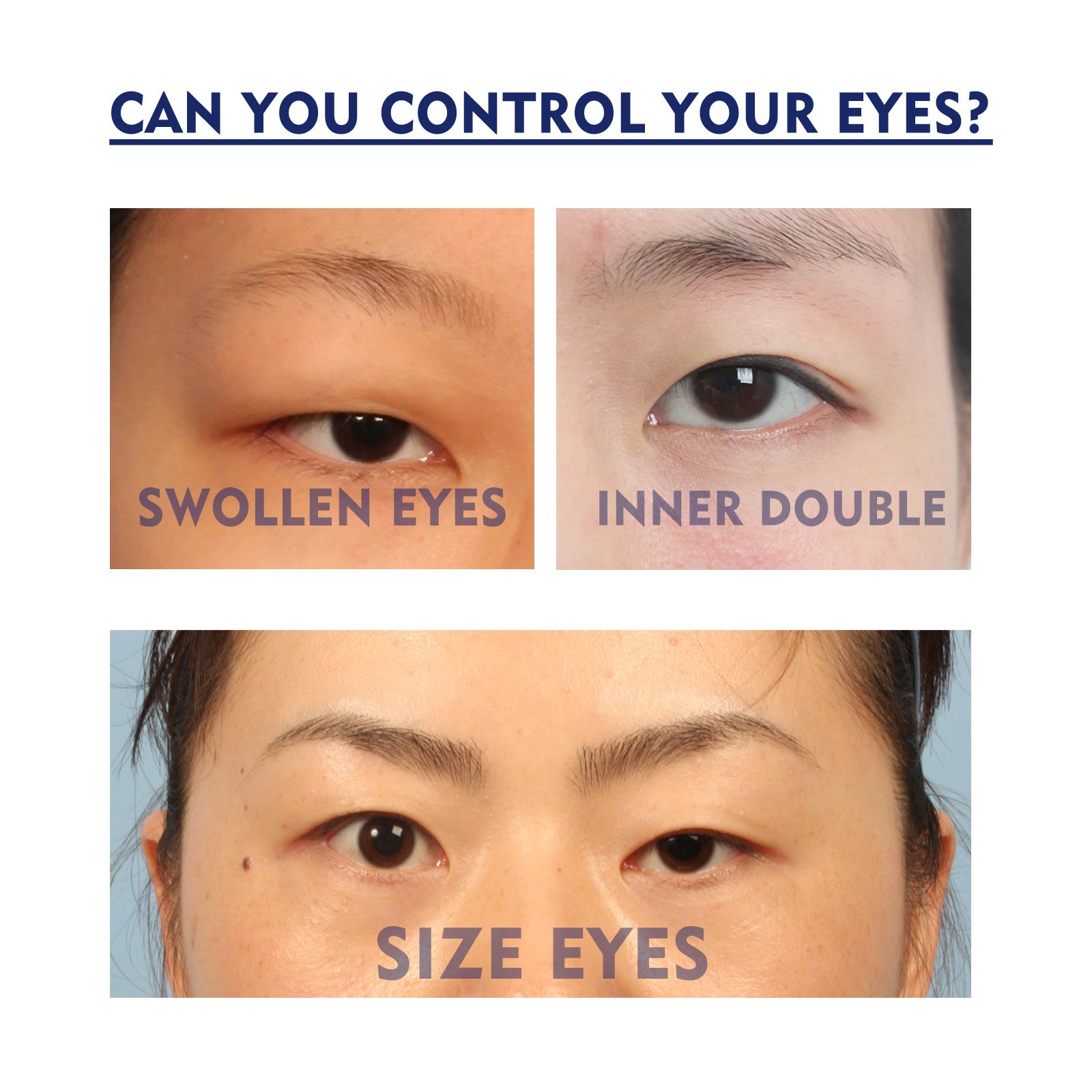 EELHOE Double Eyelid Fixing Cream – Traceless, Invisible, Waterproof, and Long-Lasting - Loxvira
