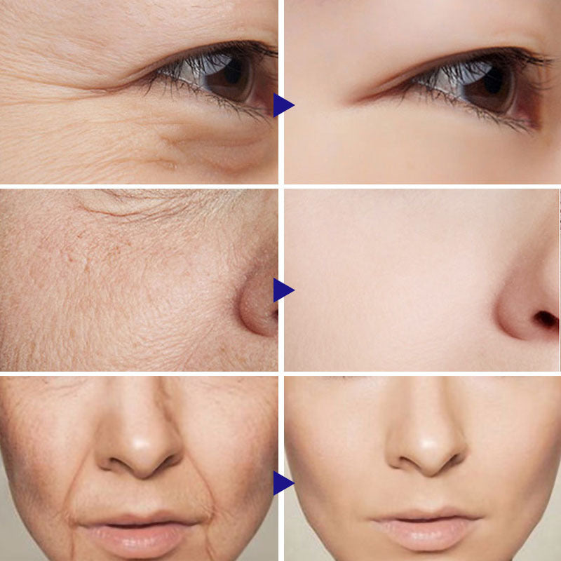 Vitamin C Serum Facial Serum Amazon - Loxvira