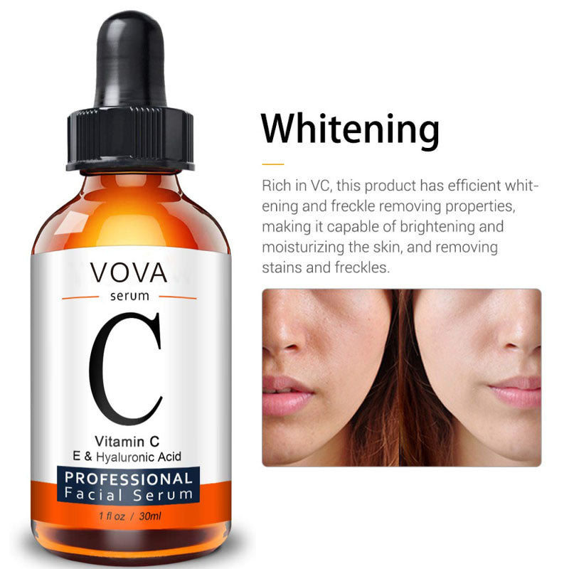 Vitamin C Serum Facial Serum Amazon - Loxvira
