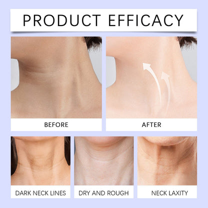 OUHOE Anti-Aging Neck Cream: Visibly Smooth Fine Lines & Firm Crepey Skin with Hydrating Rejuvenation