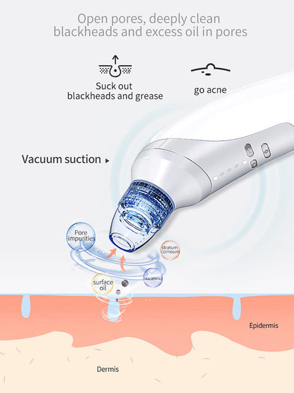 Electric Blackhead Suction Instrument – Home Use Blackhead & Acne Removal Device - Loxvira